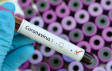 Coronavirus - Contenimento Epidemiologico